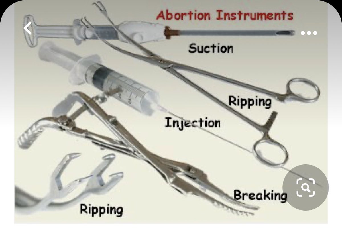 Follow360News's tweet image. BREAKING ABORTION NEWS 🚨

This is what a 15 week #abortion involves. These instruments would #murder and tear up a fully alive, sentient, #preborn child. 

#RT ⬅️
#Pray 🙏🏻

#Jesus #Children #TruthAboutAbortion #Infanticide