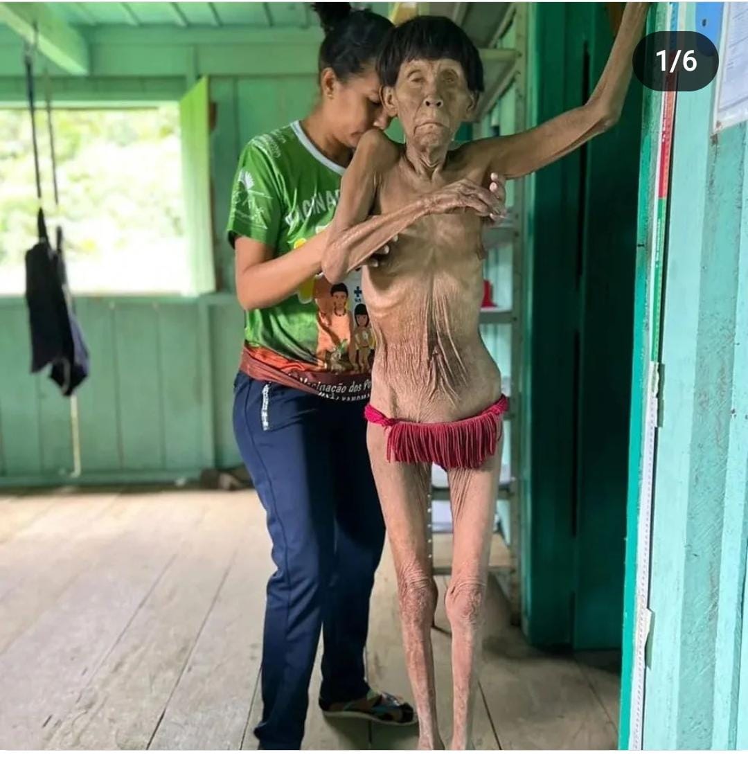claudiopedrosa8's tweet photo. Sabe quem fez isso? Bolsonaro!!! Mais de 500 Yanomami morreram nos 4 últimos anos, na maioria por desnutrição. Os garimpeiros na região não permitem que eles procurem alimentos na selva, e esse GENOCIDA não fez nada, apenas passeava de moto. https://t.co/SRUDJs1Gom