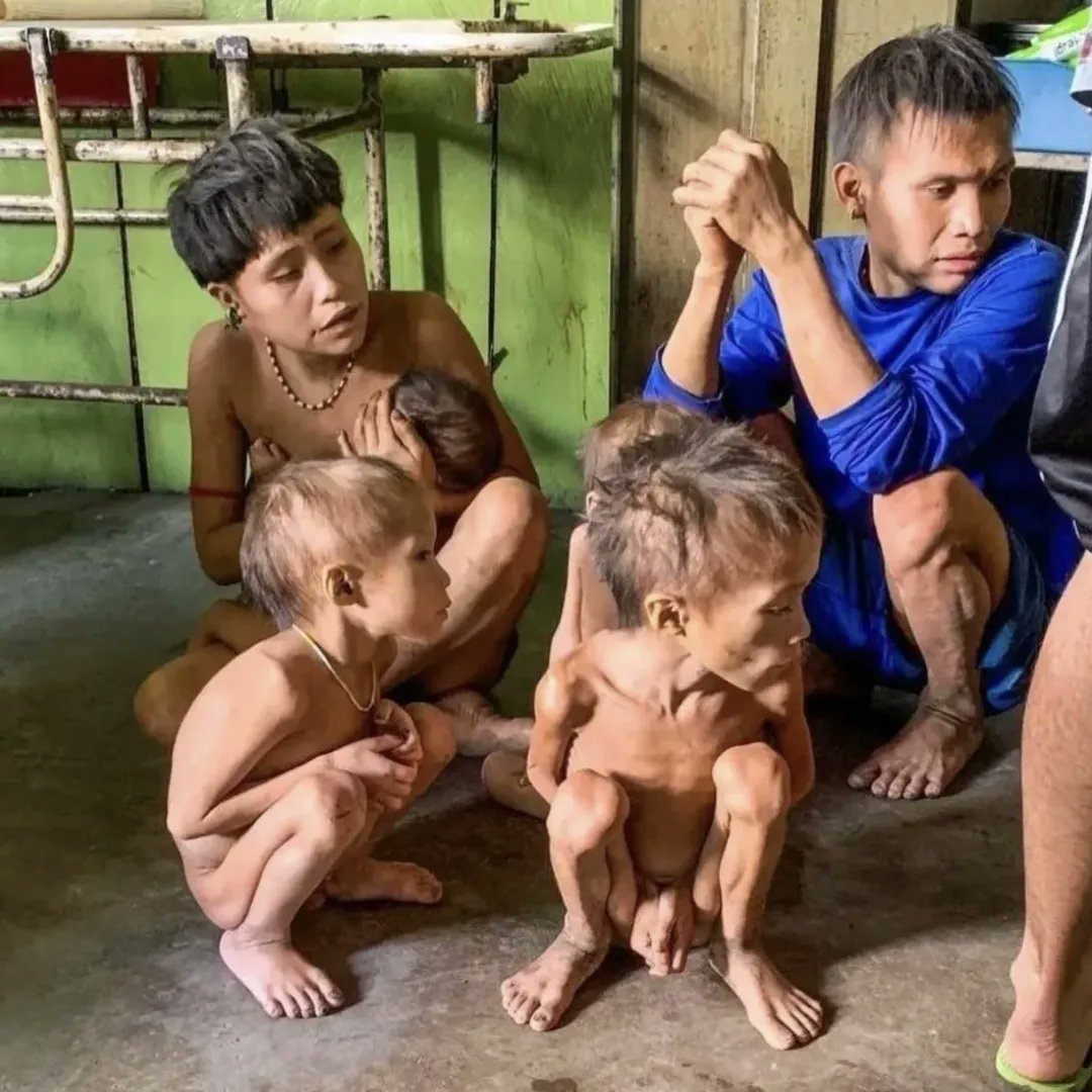 claudiopedrosa8's tweet photo. Sabe quem fez isso? Bolsonaro!!! Mais de 500 Yanomami morreram nos 4 últimos anos, na maioria por desnutrição. Os garimpeiros na região não permitem que eles procurem alimentos na selva, e esse GENOCIDA não fez nada, apenas passeava de moto. https://t.co/SRUDJs1Gom