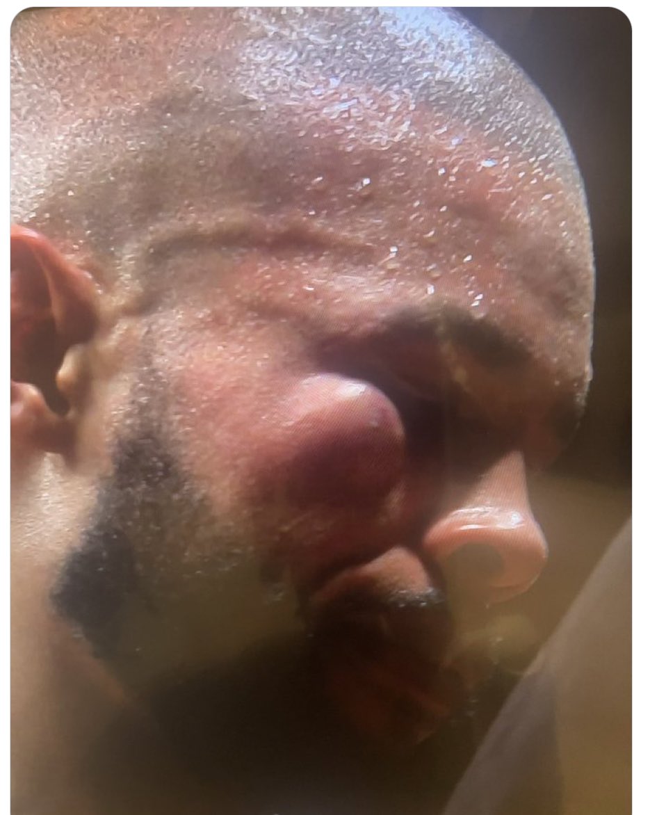 theanfieldiron's tweet photo. @racingblogger @ChrisEubankJr Must be a torie https://t.co/pwnqsmZTxb