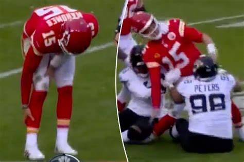 It looked like Patrick Mahomes suffered a valgus-external rotation injury to his right ankle, causing deltoid ligament & syndesmotic (high ankle) sprains. His x-rays at halftime must have been negative for fracture but I would expect him to get an MRI tomorrow. #ChiefsKingdom