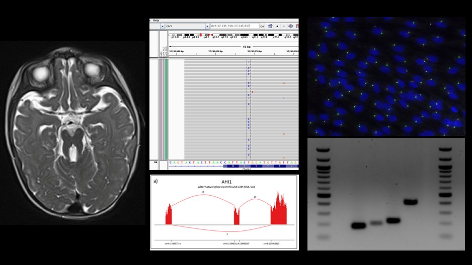Interested in research on human brain malformations and living in awesome Seattle? Apply for the <a href="/Dohertylab/">Dan Doherty</a> research scientist position bit.ly/3X9WQKU to learn bench and computational techniques. It’s a great stepping stone to a biomedical research or healthcare career.
