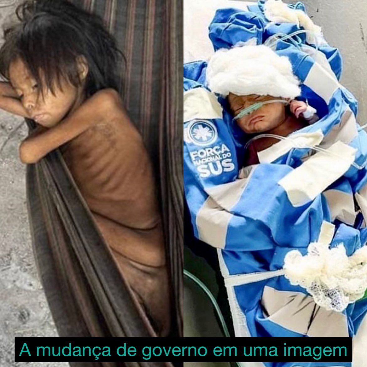 Para que serve o Estado ? “Quando digo governar, quero dizer cuidar. Vou cuidar com muito carinho deste país" A fala de <a href="/LulaOficial/">Lula</a> tornada imagem. Um governo que gere vida e um que deixou morrer. A vida acima de tudo! #SOSYanomami instagram.com/p/Cnsv4K4LUW9/…