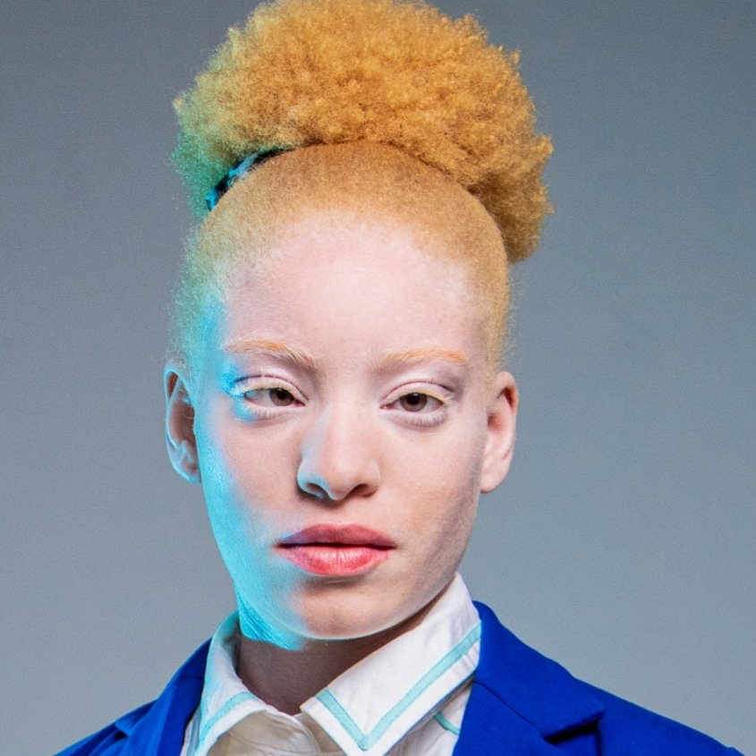Congratulations to Andreia Solange Sicato Muhito for being  selected as the finalist representing Angola  for the upcoming Mr and Miss Albinism Southern Africa.
The idea of the initiative is to give them a sense of pride to make it easier ...
#angolainthehouse🇦🇴