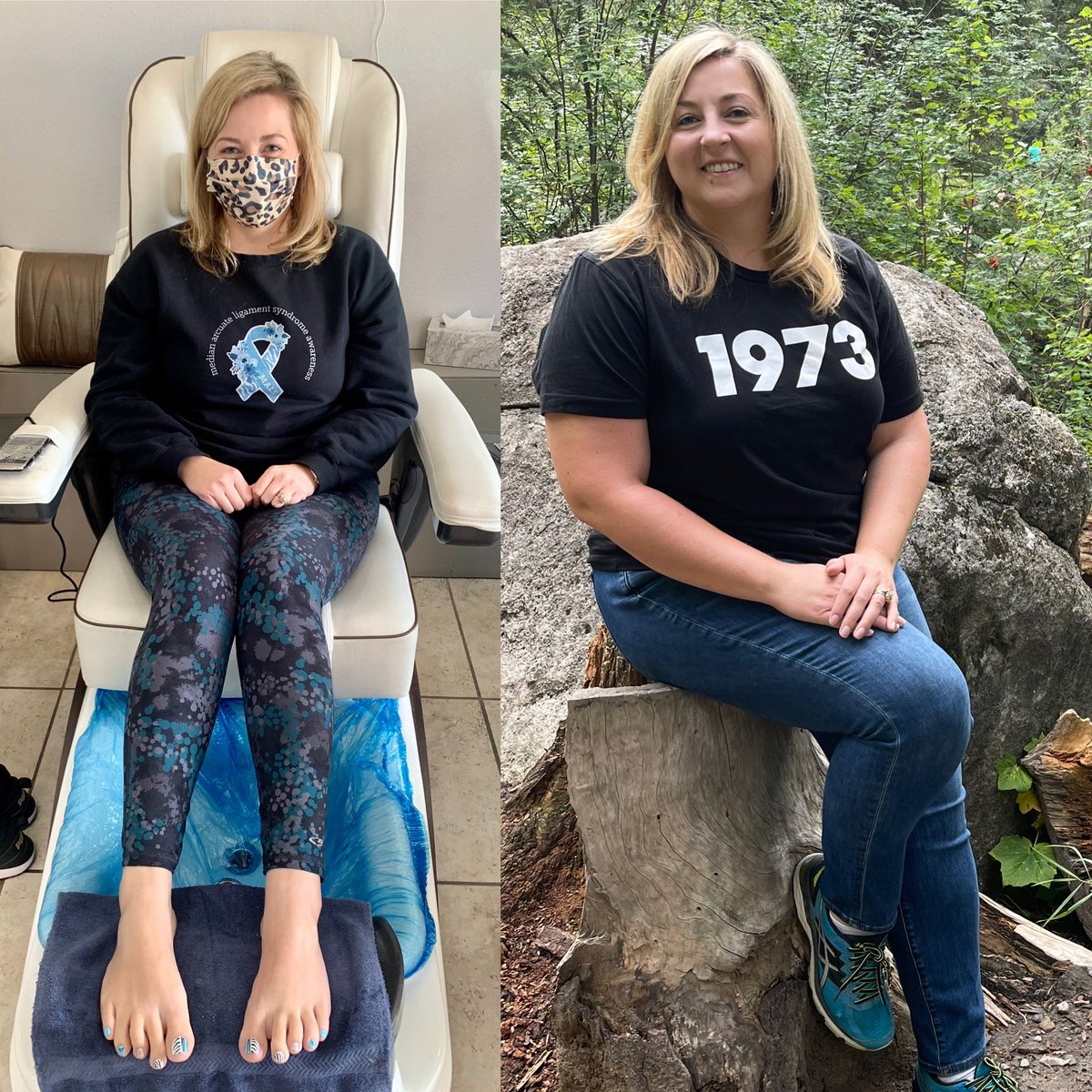 b_r_atkinson's tweet photo. 3 months apart. While weight loss is great, starvation due to extreme pain from eating sucks. February is MALS awareness month. I’m 2 weeks out from MALS surgery 🙏🖤🦋 @GovMLG @MartinHeinrich @BCBSNM @HCSC I’m still praying for medical cost coverage https://t.co/QiO7pgaV8i