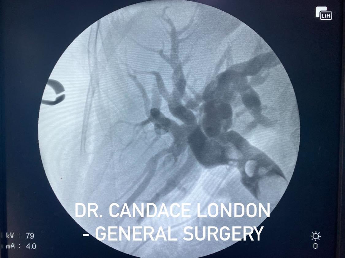 Dr. Candace London - General Surgery tweet media