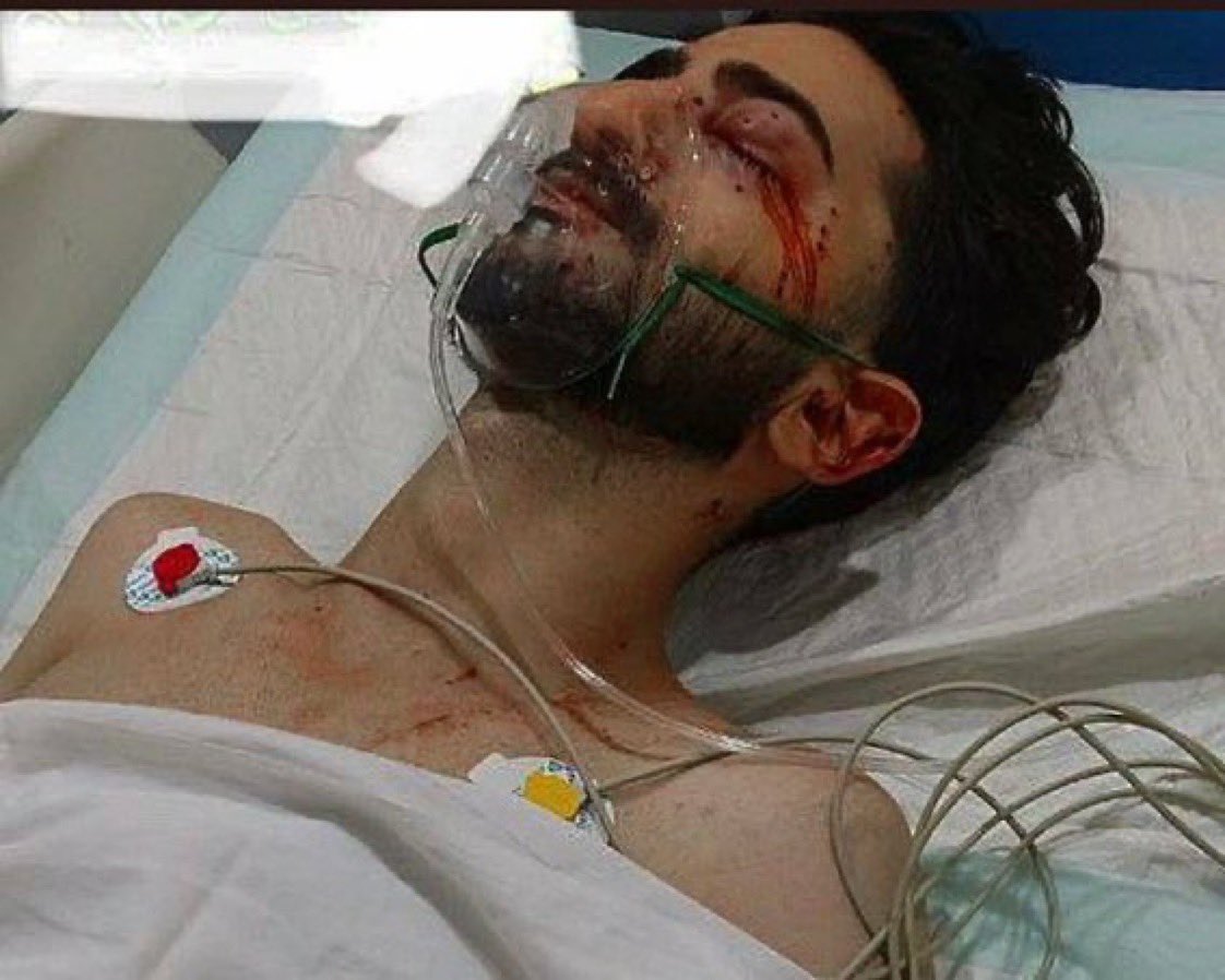 🏮 برای چشم هایی که خون گریست.🥀 روز آخره نفری ده تا. 