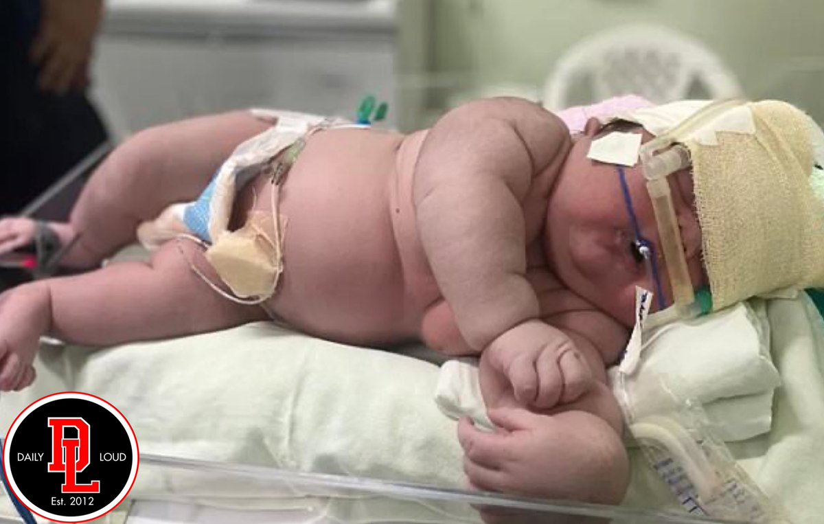 DailyLoud's tweet photo. Brazilian Mother gives birth to a giant baby measuring 2ft tall and weighing in at 16 pounds‼️👀 https://t.co/zg56AXs1Bf
