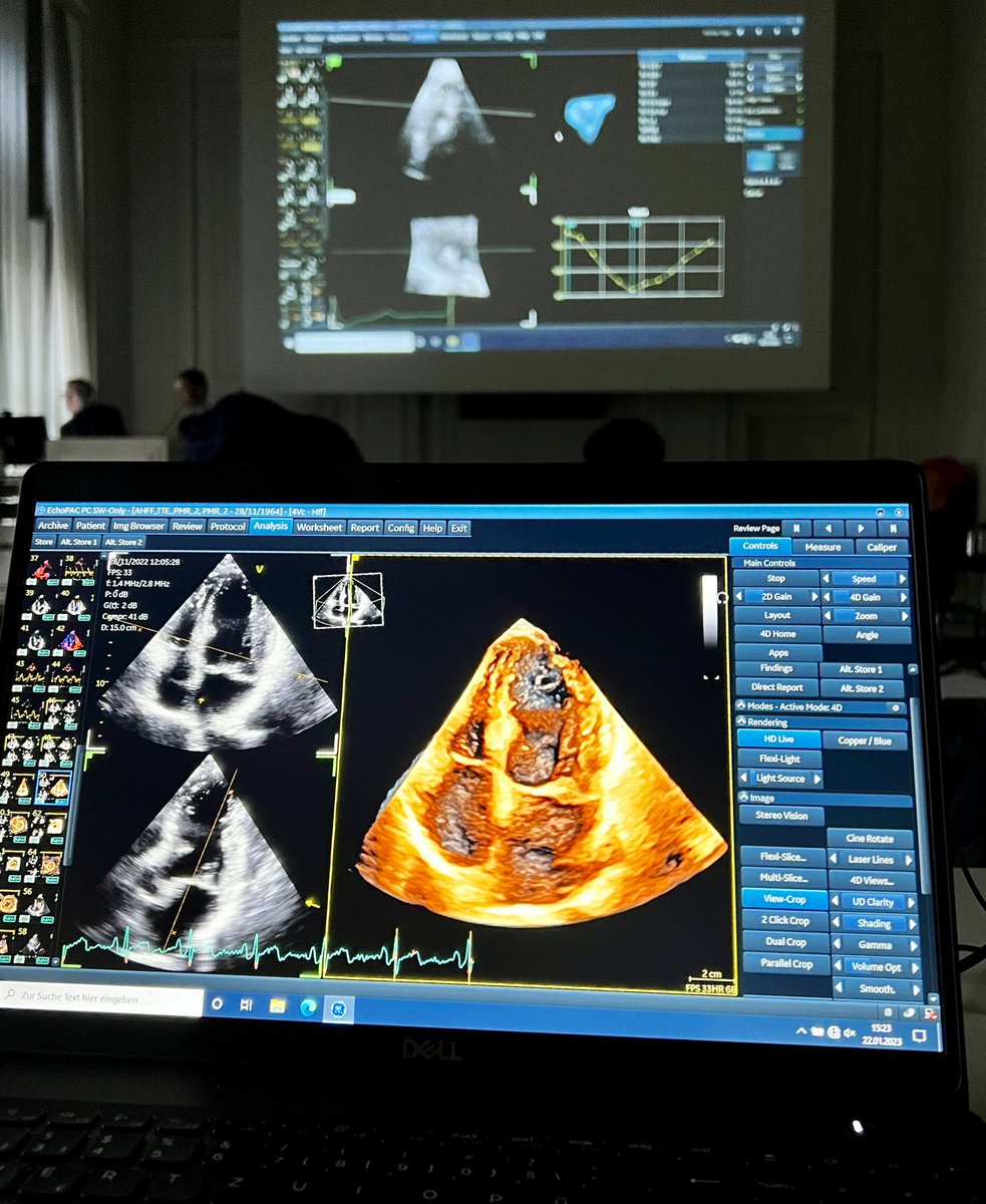 DaUnChung_MD's tweet photo. A very educational and inspiring event at @dhzcharite comes to an end with great talks and hands-on teaching on #Berlin3DEcho 🫀 Awesome faculty including @AHagendorff @VDelgadoGarcia @eromerodorta @esrakaya_dr @HenrykDreger and @NMerke  - thank you and see you soon #Berlin! https://t.co/7wI0Fovo6L