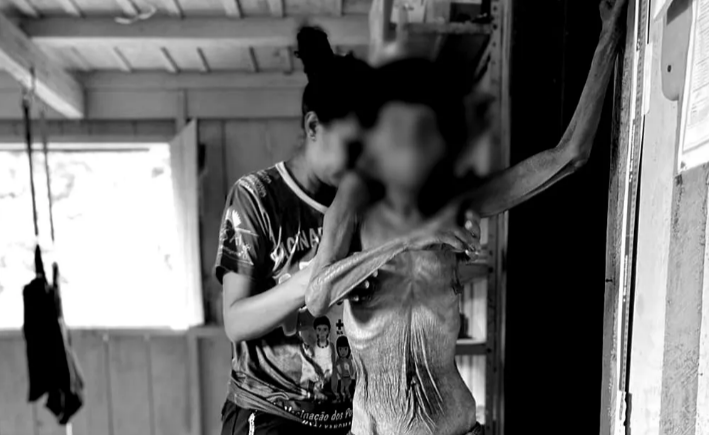 g1's tweet photo. Morre mulher Yanomami fotografada em estado grave de desnutrição https://t.co/RHWIYnpsoA #g1 https://t.co/xQ4wHim0rH