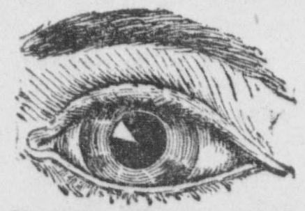 Toca recoger una muestra de exudado conjuntival. ¿Lavamos antes con suero o no? Esta es la pregunta de esta semana y a un clic tenéis la respuesta 😉 👀
cutt.ly/exudadoconj