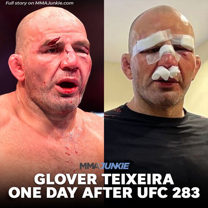 Glover Teixeira went through the ringer in his final fight. 🤕

#UFC283 | Read more: 
