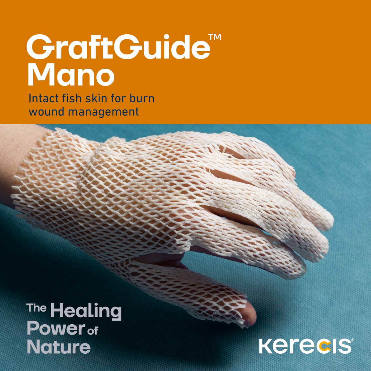 kerecis's tweet image. Kerecis is introducing GraftGuide™️ Mano at Boswick symposium this year! 👏🐟GraftGuide™️ Mano is intact fish skin with unique shape allowing it to easily cover the complex 3D structure of the hand 🫳
Learn more: bit.ly/3J7xPwj
#Boswick #burn #fishskin #Kerecis