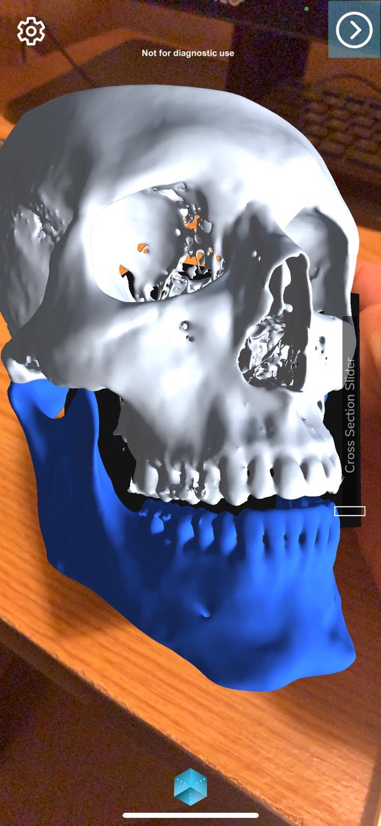 Looking forward to showing our #AugmentedReality work at #IMSH23. Swing by booth 855 to see our innovative work, in #MedicalEducation and preop planning! #Simulation @SSHorg