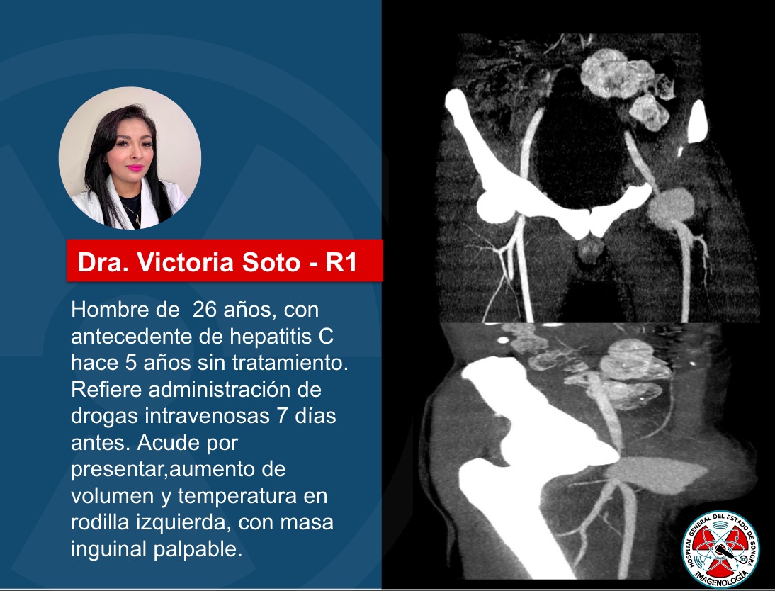 Les traemos las imágenes del caso semanal, ¿Cuál es tu diagnóstico?
#CT #FOAMed #radres