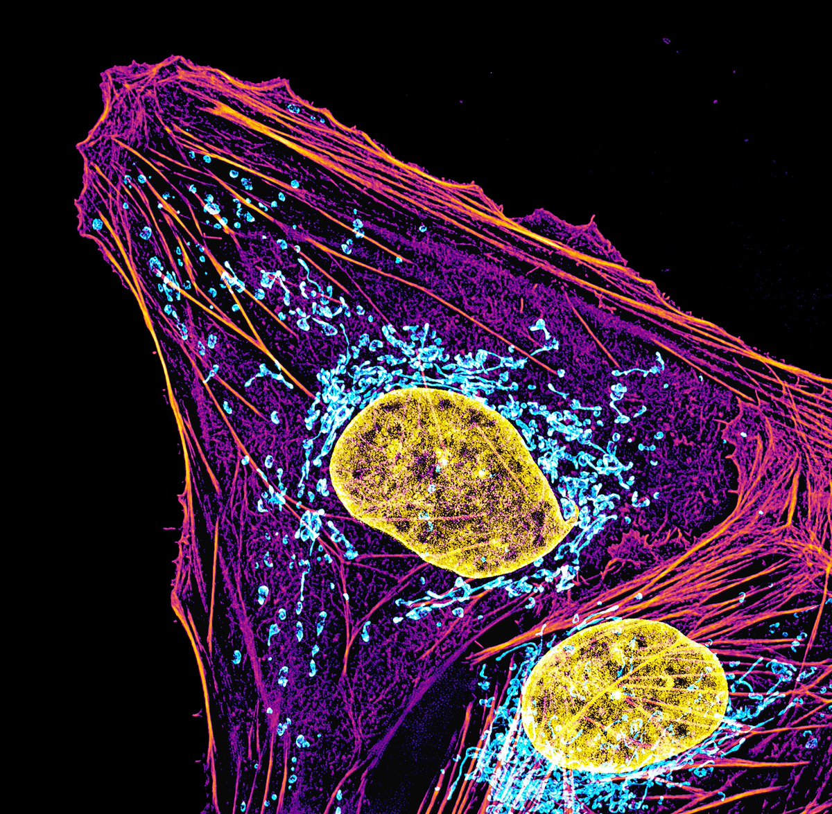 A cell photographed through a microscope. DNA in the nucleus (yellow), the powerhouses of the cell, mitochondria (cyan), and actin filaments (magenta-ish) are shown. #CellBiology