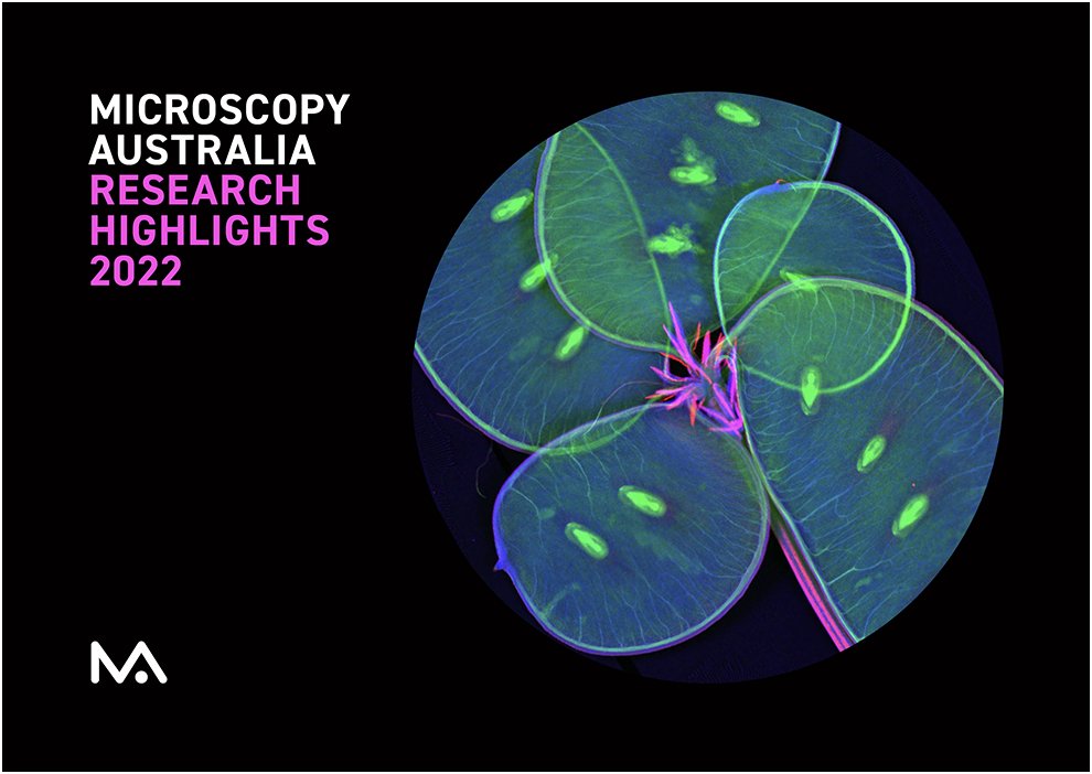 Check out our 2022 Research Highlights! Fantastic stories from around the Microscopy Australia network.

Download here: micro.org.au/documents/2022/

#NCRIS_impact <a href="/CMMUQ1/">CMM@UQ</a> <a href="/BronwynHarch/">Bronwyn Harch</a> @CMCA_UWA <a href="/SimsNano/">nanoSIMS@UWA</a> <a href="/ChiefSciWA/">Prof Sharath Sriram</a>  <a href="/CryoEM_Monash/">Ramaciotti Centre for Cryo EM</a> <a href="/MCEM_Monash/">Monash Centre for Electron Microscopy (MCEM)</a> @Vic_LeadSci <a href="/UniSAFII/">UniSA Future Industries Institute</a> <a href="/sachiefsci/">Chief Scientist for South Australia</a>
