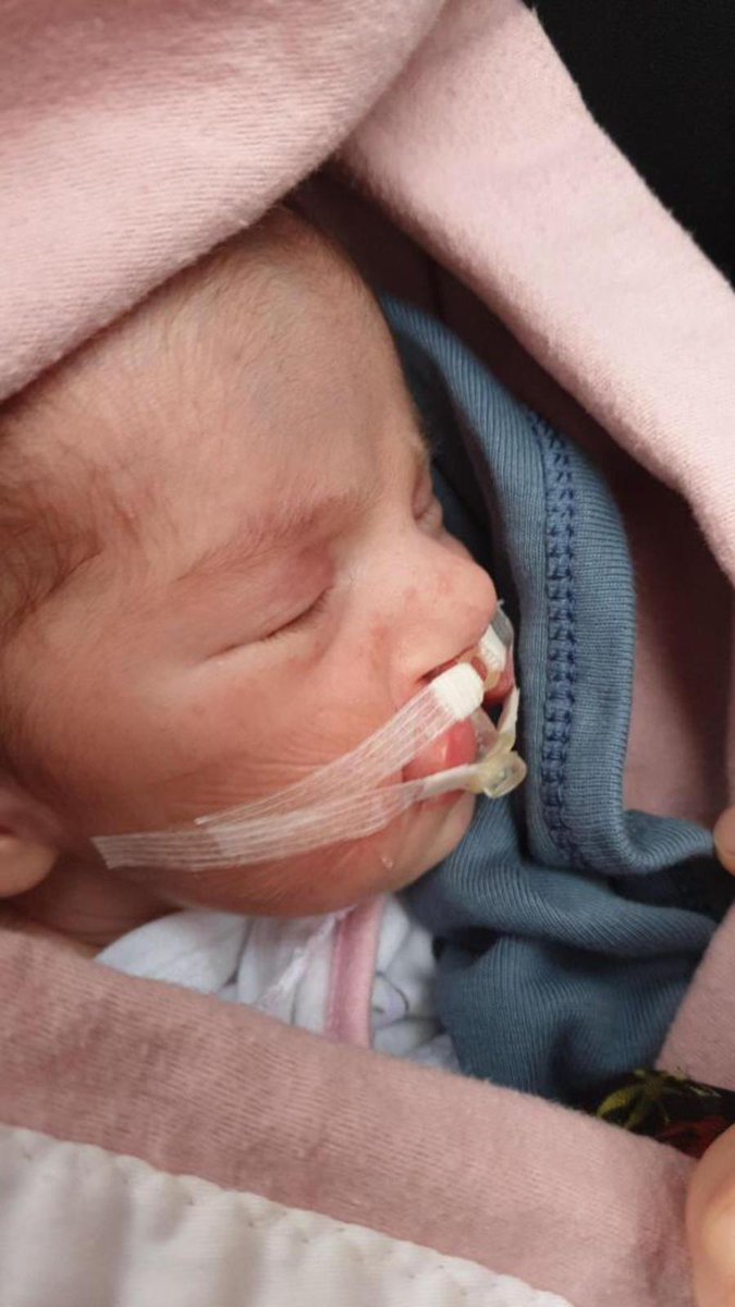 Bir ay önce ameliyat edilen, mart ayında yeniden ameliyat edilecek olan 3 ay aylık Seniha Bahar bebek hapse atılalı 4 gün oldu. Dört koca gün. Söz tükendi artık.

Bebekli anneleri serbest bırakın? <a href="/adalet_bakanlik/">T.C. Adalet Bakanlığı</a>