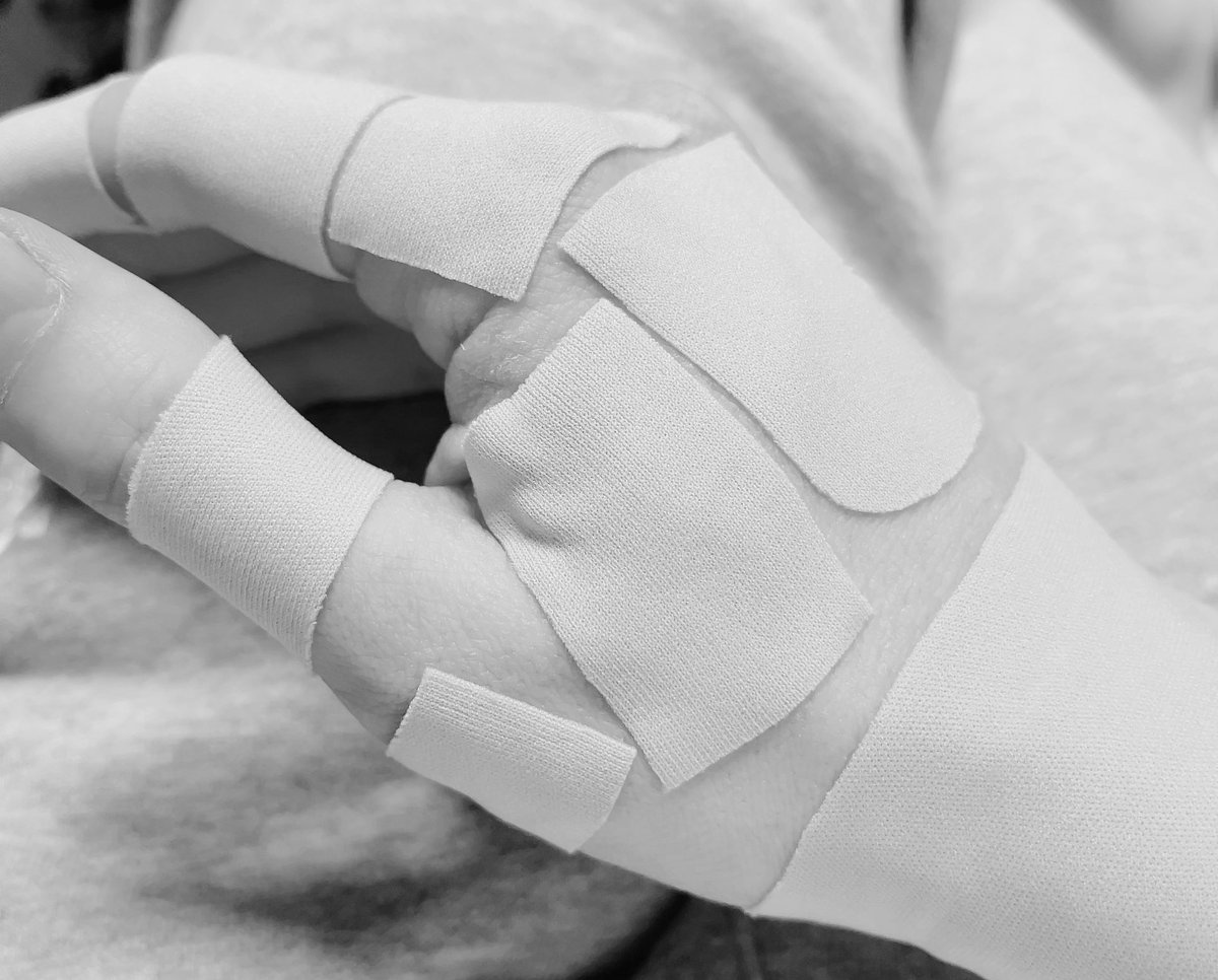 手動でナスバゼ周回した末路。
右手負傷してます。