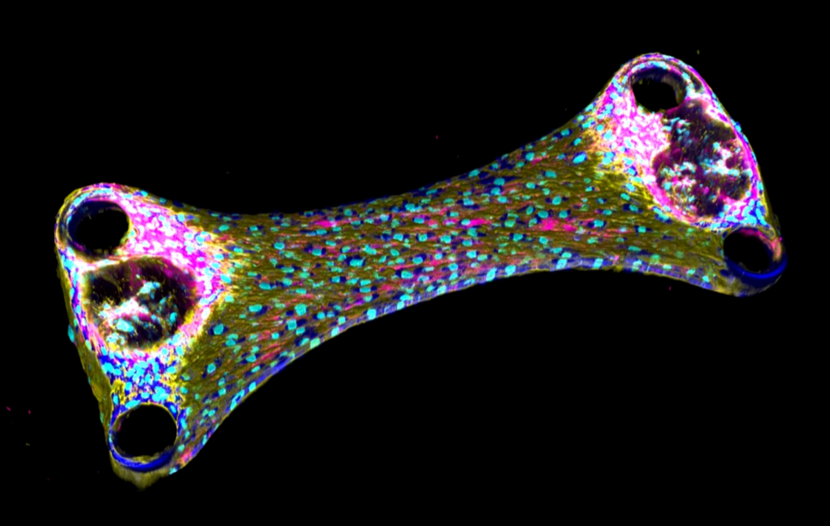 Dit is ons mooiste microscopieplaatje van het jaar 2022! Het is een mini-botje, gemaakt uit menselijke cellen door promovendus Judith Schaart. Met fluorescerende stoffen zijn de verschillende onderdelen ingekleurd. Met als gevolg een klein wetenschappelijk kunstwerk! #botvorming