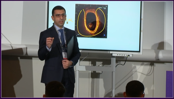 PCRonline's tweet photo. Planning treatment strategies in multivessel disease

#Physiology and imaging are important tools to learn to use in the #cathlab: watch the replay 📺of this session focusing on the case of a 66-year-old female patient  

https://t.co/HW1xaCTp2j #cardiotwitter #MedEd 
@MilasinD18 https://t.co/EmhdxrtBUs
