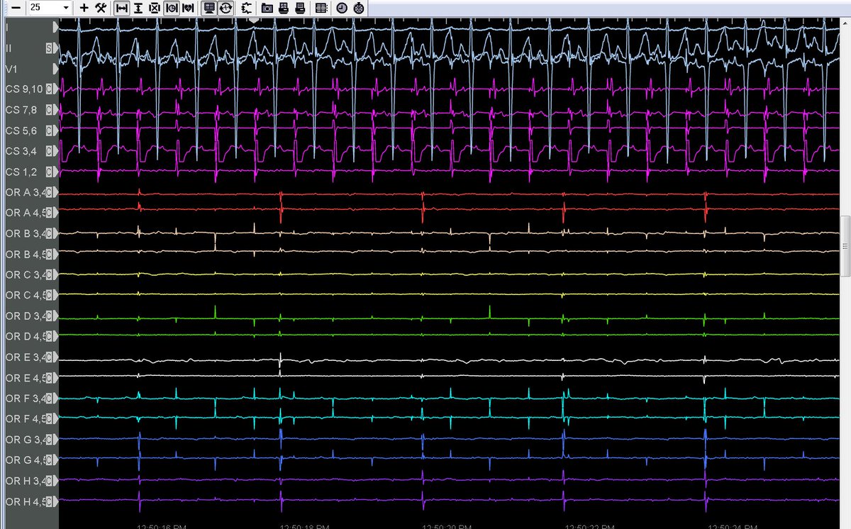Mike Manogue tweet media
