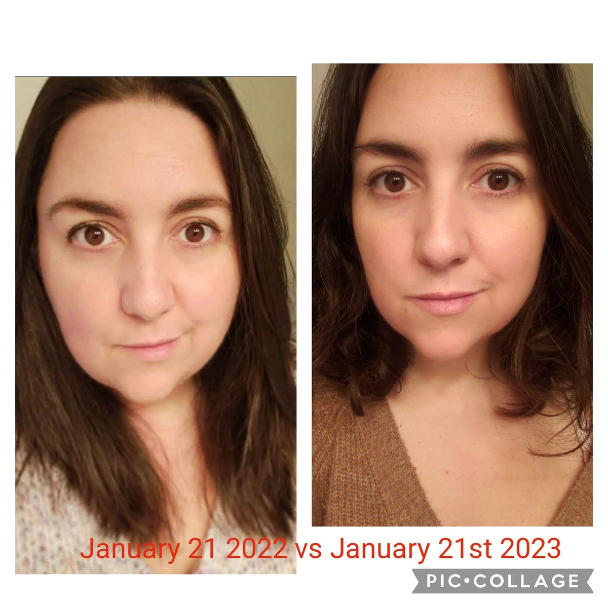 victwebb's tweet photo. The other day I shared this face to face on Instagram. And I literally cannot get over how puffy my face looked last year to this year.
I feel like it may be subtle to others. But to me, it feels so different. https://t.co/NT63eeWUBk