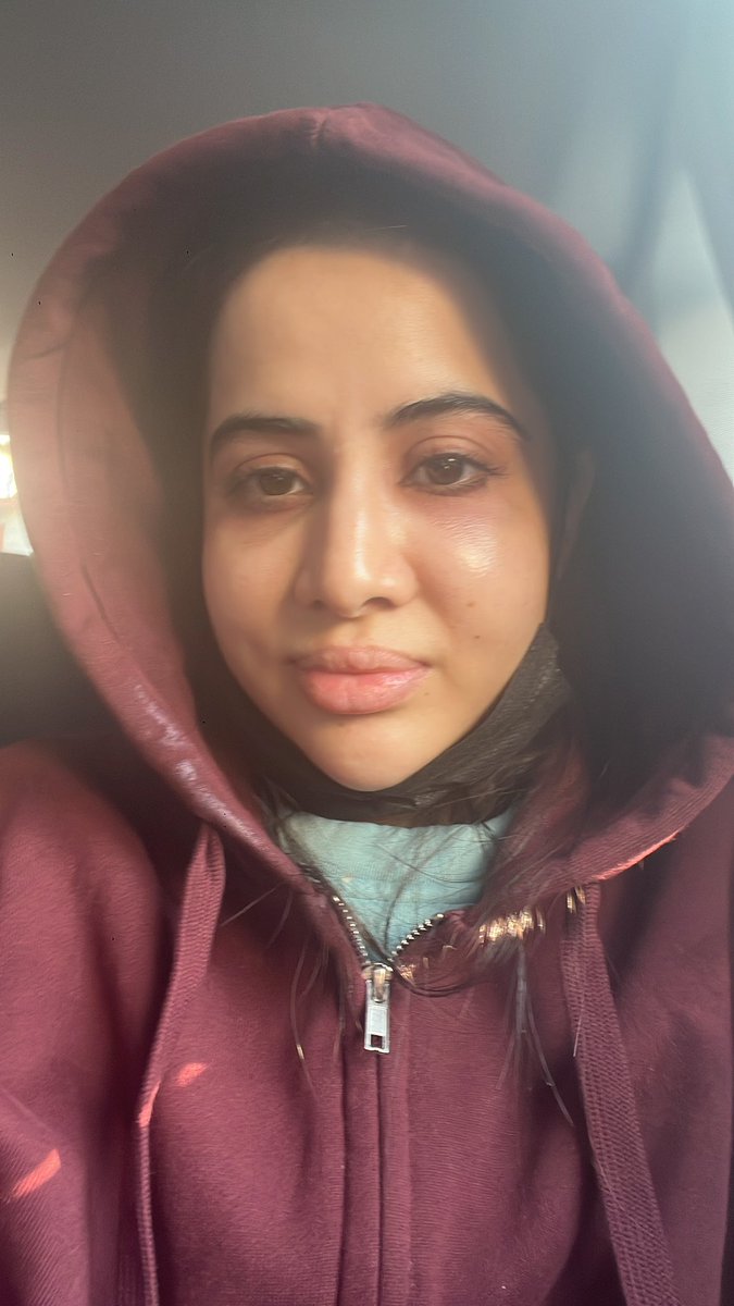 uorfi_'s tweet photo. Kya se kya ho Gaya !  When allergies hit 
Who do I resemble right now ? https://t.co/7jEJkcPi9p