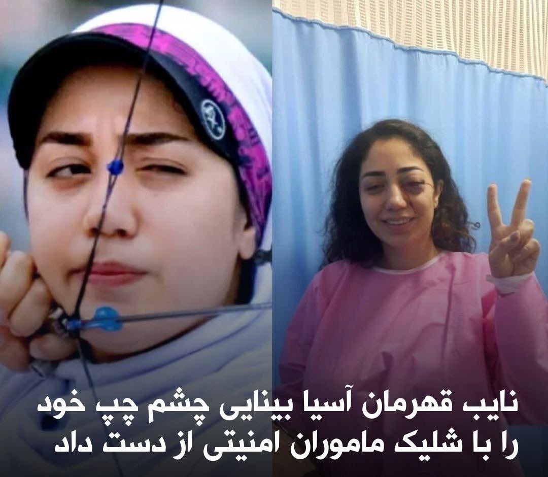 Shahinlooo's tweet photo. #کوثر_خشنودی‌کیا، نایب قهرمان مسابقات تیراندازی با کمان آسیا در کرمانشاه و در جریان خیزش ملی از ناحیه چشم و به دلیل شلیک مستقیم مزدوران کثیف خامنه ای قرار گرفت و علی‌رغم عمل‌ جراحی بینایی چشم چپ خود را از دست داد.
#مهسا_امینی https://t.co/zBnb7CU8ol
