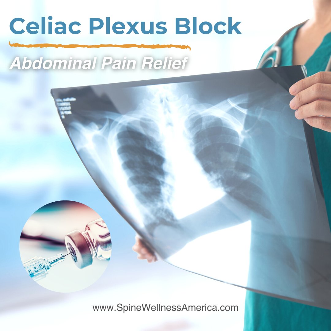 An injection of local anesthetic is used to block the celiac plexus nerves that transmit pain signals from your abdomen to your brain

spinewellnessamerica.com 

#paindoctor #SouthFlorida  #chronicpain #spinewellnessamerica #celiacplexusblock #plexusblock #celiacblock #celiac