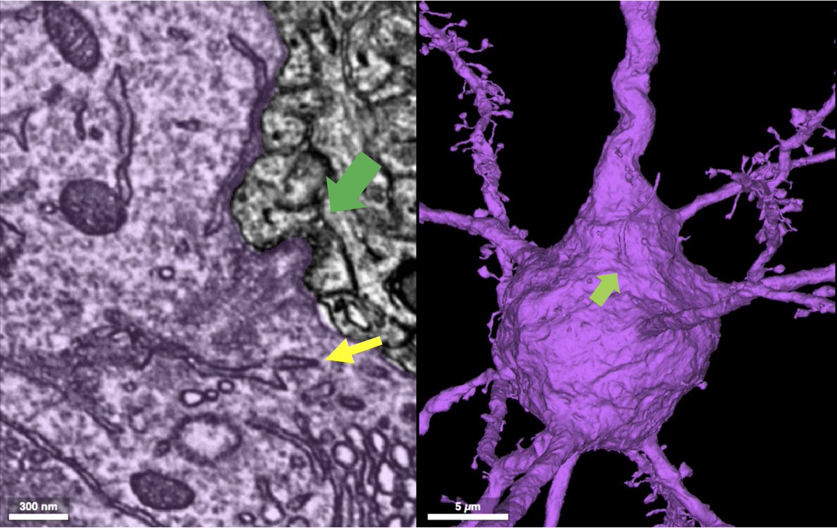 HaniehFalahati's tweet image. This #EM_Monday, I will share some images of neuronal cilia and their association with ER. Green arrows in these images show cilia and yellow arrows show ER, at the base of cilia. Do all cilia have ER cupping their base? NO! But it does happen in some neurons, two shown here. /1