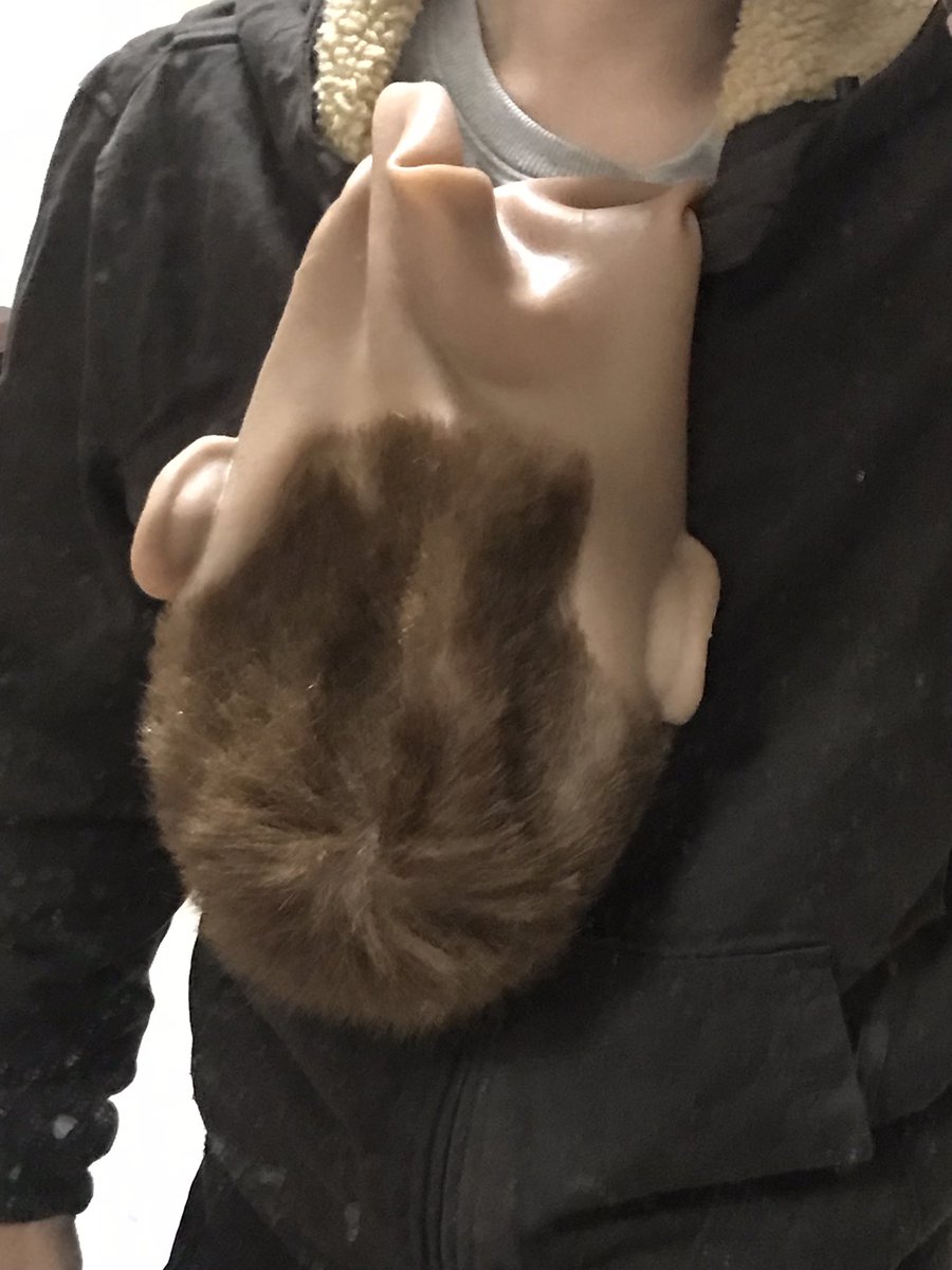 Your skin is falling off!