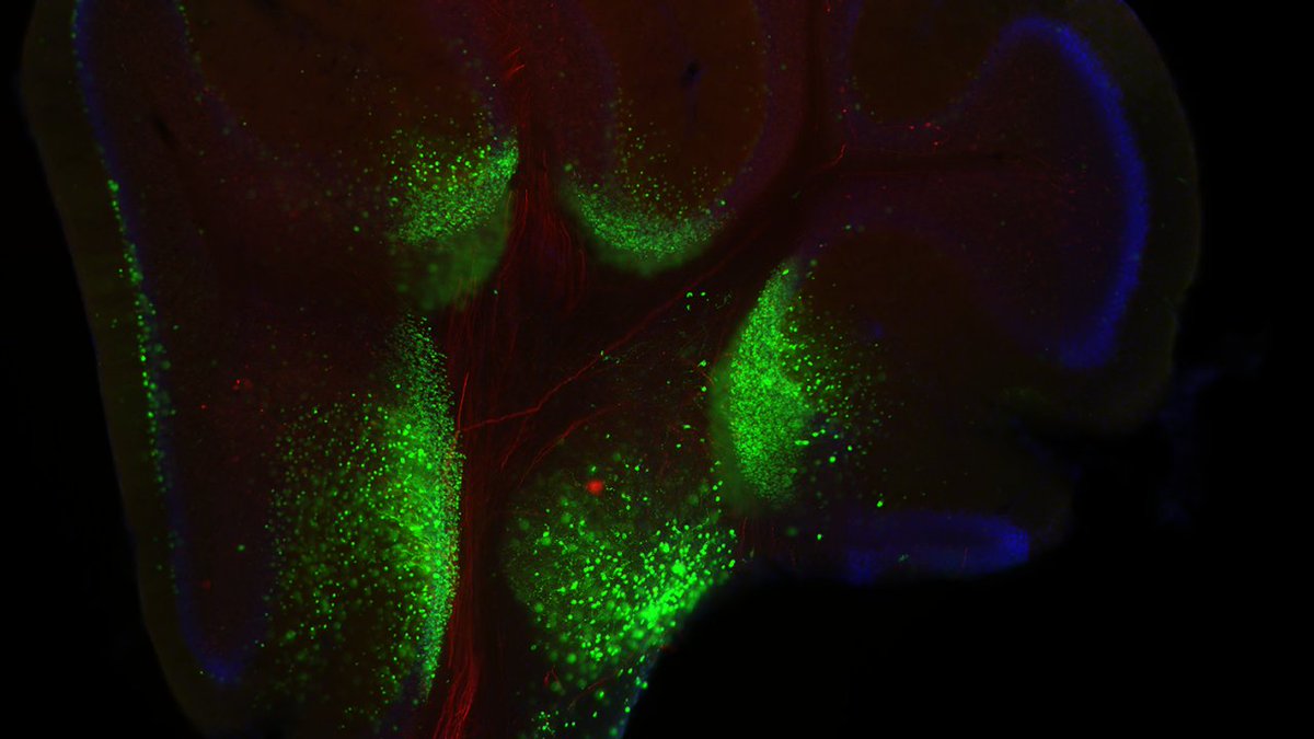Center for Neuroscience researchers unravel the mysteries of the brain to advance healthcare, find therapies and cures for neurological and psychiatric disorders and inspire the development of transformational new technologies.  #Neuroscience #Cerebellum