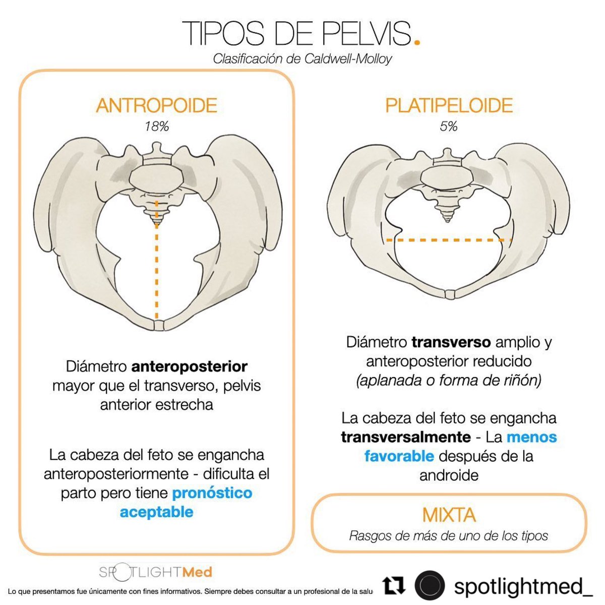 Tipos de Pelvis 🤰🏻#spotlightmed #spotlightmedicine #medcoach #enarm #enarm2023 #medicina #estudiantemédico #medstudent #medstudentlife #mip #mpss #ginecologia #obstetricia #obgyn #obstetrics #gynecology