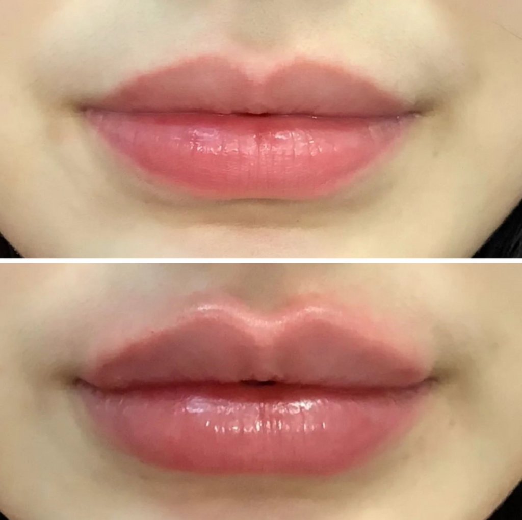 MD_Spa's tweet image. Contact us today:
Call: (780)9299797
Text: (780)9349021
DM: @MDSPALASER
Email: beaumont@mdspa.ca
Web: mdspa.ca

#edmonton #yeg #yeglocal #yegbusiness #alberta