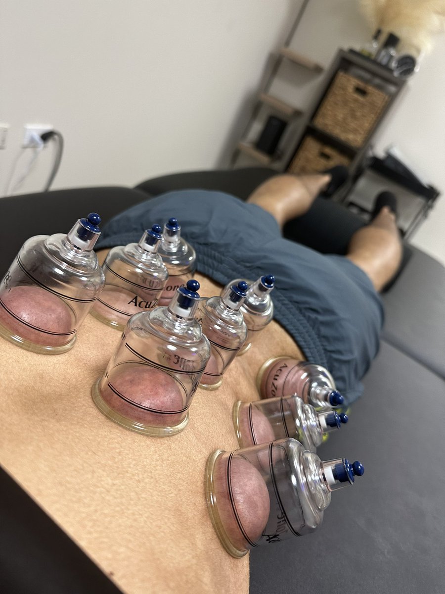 reactivebda's tweet image. Are you tired of pain keeping you from moving? 

At Reactive, we combine hands-on therapy and exercise to ensure your body’s ready for all your movement aspirations. We’re determined to keep you moving pain free!

Book an appointment today. Link in bio!