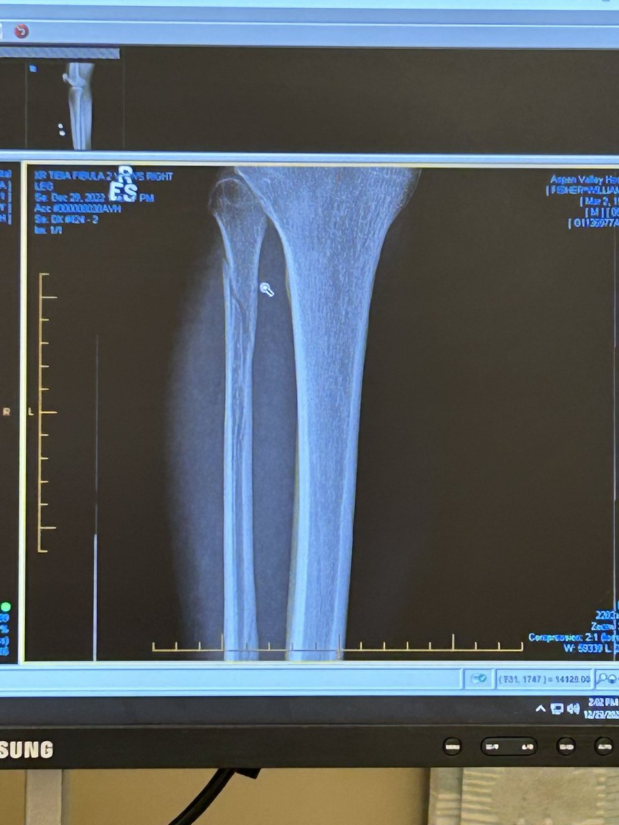 WillFis95422355's tweet image. Before the booster and after the booster #correlationnotcausation