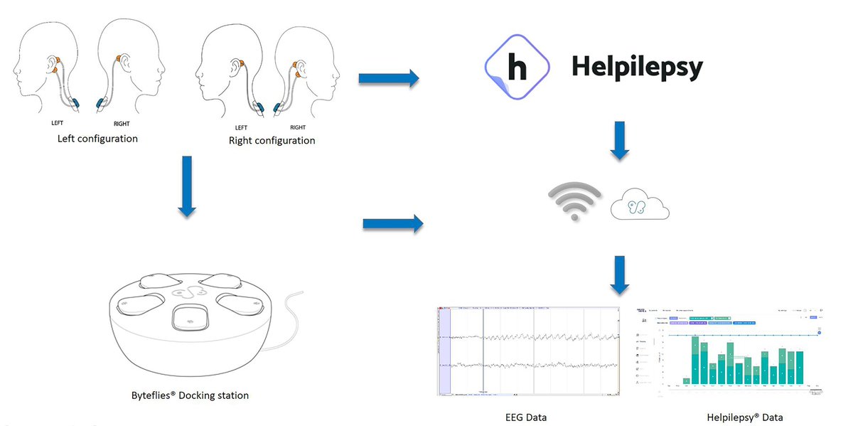 EpilepsiaJourn's tweet image. In‐hospital and home‐based long‐term monitoring of focal epilepsy with a wearable electroencephalography device. Diagnostic yield and user experience.  onlinelibrary.wiley.com/doi/10.1111/ep… 

#epilepsy #seizuredetection #wearabledevices #machinelearning #focalseizure @IlaeWeb @WileyNeuro