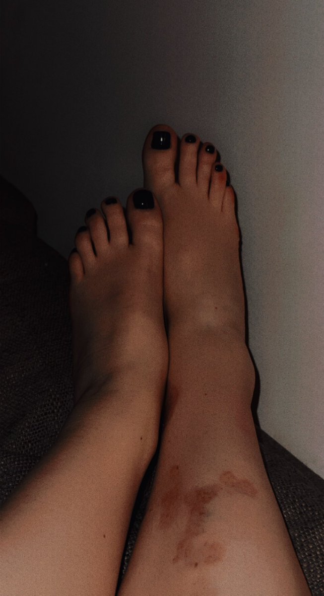 OfLivxo's tweet photo. #feetfethish #feetpicsforsales #feet #skinny #stretched #navynails #FeetPicture https://t.co/CmUVf3zALO