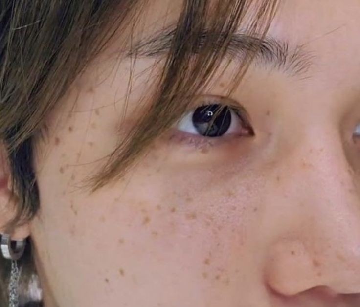 isi_isaa's tweet photo. 👤:Con respecto a tus pecas, durante la sesión mencionaste sutilmente que, ¿querias quitártelas cuando eras joven?

🐥Realmente las odiaba cuando era joven. Cuando tenia cinco años, descubri que era el único coreano con pecas en mi vecindario. Recuerdo haberlo odiado porque + https://t.co/SexwPoqDbb