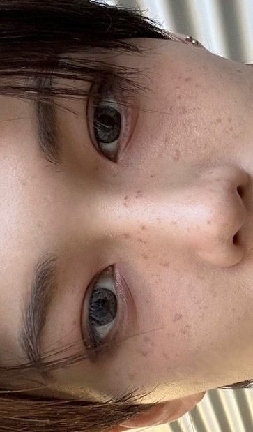 isi_isaa's tweet photo. 👤:Con respecto a tus pecas, durante la sesión mencionaste sutilmente que, ¿querias quitártelas cuando eras joven?

🐥Realmente las odiaba cuando era joven. Cuando tenia cinco años, descubri que era el único coreano con pecas en mi vecindario. Recuerdo haberlo odiado porque + https://t.co/SexwPoqDbb