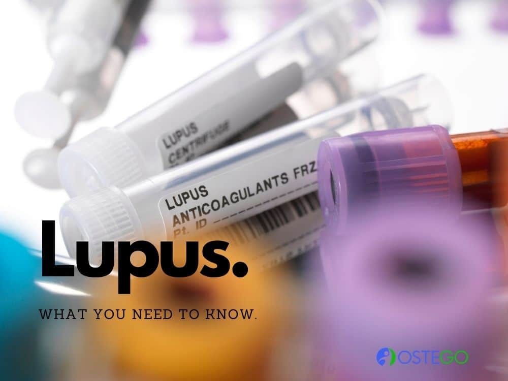 OstegoLife's tweet photo. Lupus is a chronic, progressive condition that occurs due to inflammation in the skin, joints, and other organs and tissues in the body.

#lupus
#symptomsoflupus
#riskfactorsoflupus
#Lupusarthritis
#Lupusmyositis
#Bursitis
#Tendonitis  
#aging
#anti-aging
#osteoporosis
#Ostego https://t.co/ug6GIkRQpO
