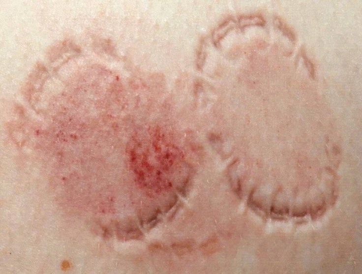 M 🔻 Я . N Ξ R 0 (@_mvr_n3r0_) on Twitter photo 