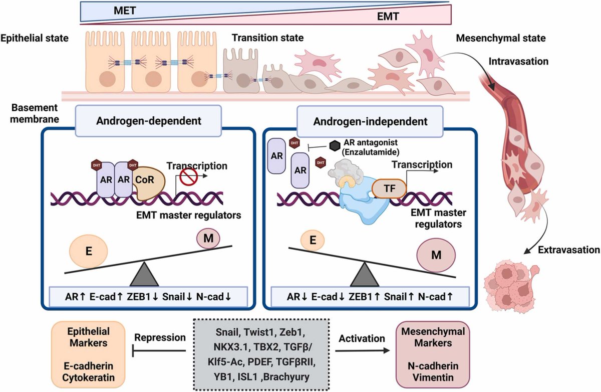 Happy to share our recently published review article in the Seminars in Cancer Biology <a href="/ElsevierConnect/">Elsevier</a>. Incredible efforts put by <a href="/ManzarNishat/">Nishat Manzar</a>, <a href="/PromitGanguly22/">Promit Ganguly</a> and <a href="/umar_k_khan/">Umar Khalid Khan</a>   
sciencedirect.com/science/articl…