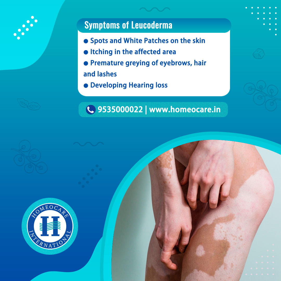 homeocareint's tweet photo. Symptoms of Leucoderma
●Spots and White Patches on the skin
●Itching in the affected area
●Premature greying of eyebrows, hair and lashes
●Developing Hearing loss

Please call 9535000022 to get more information from our experts and to book your appointment.

#Leucoderma https://t.co/K4m4ADzXEO