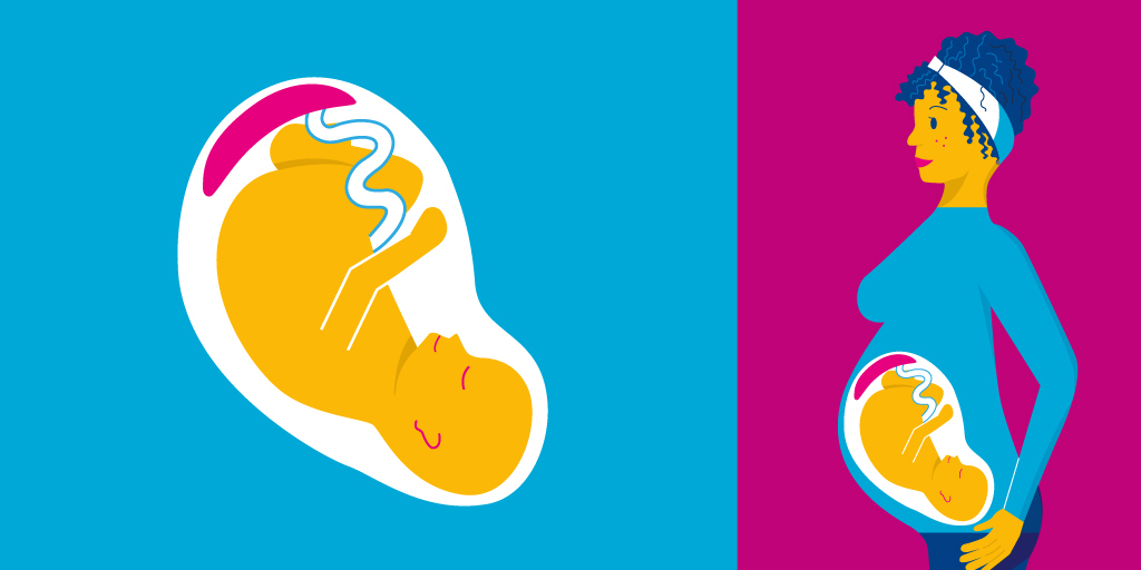 Your birth plan is a way for you to communicate to midwives and other health professionals how you would like to give birth.

Take a look at our useful digital Journey to Parenthood booklet here: gloshospitals.nhs.uk/media/document…