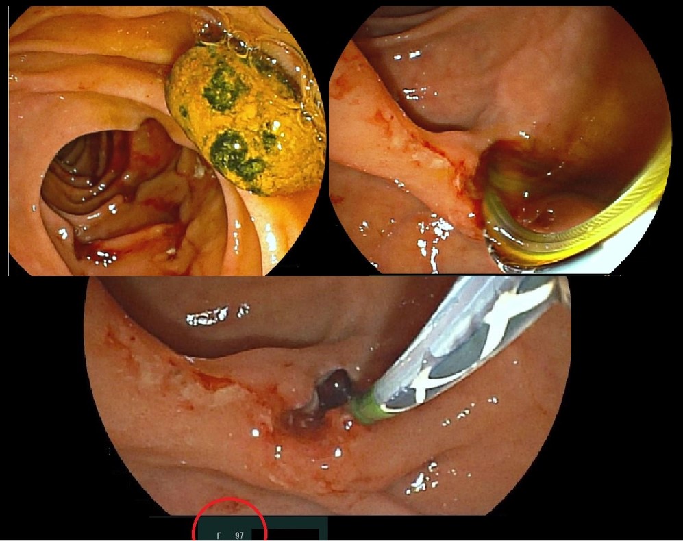 EndoDocAix tweet media
