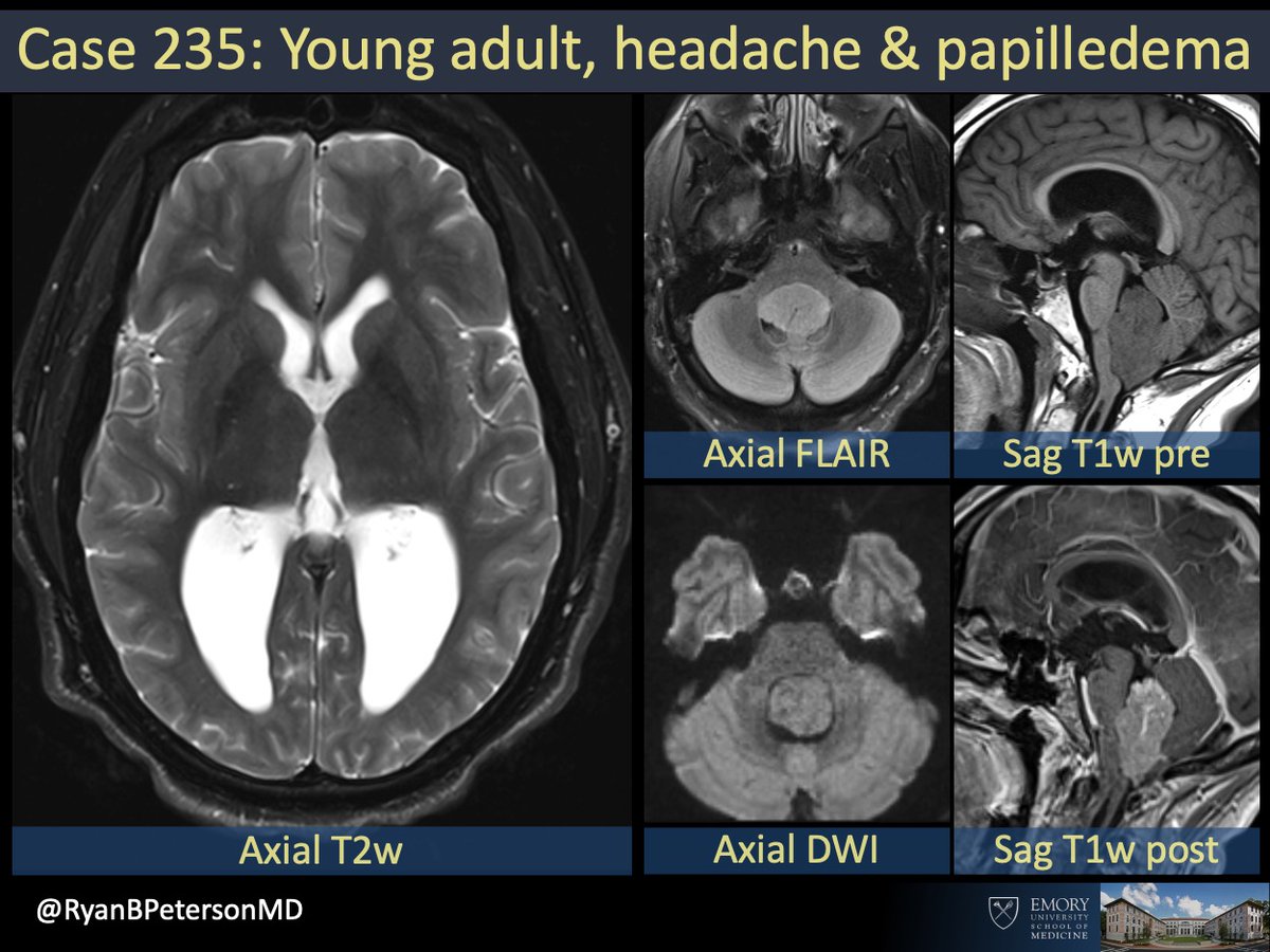 Ryan B Peterson 🇸🇪 tweet media