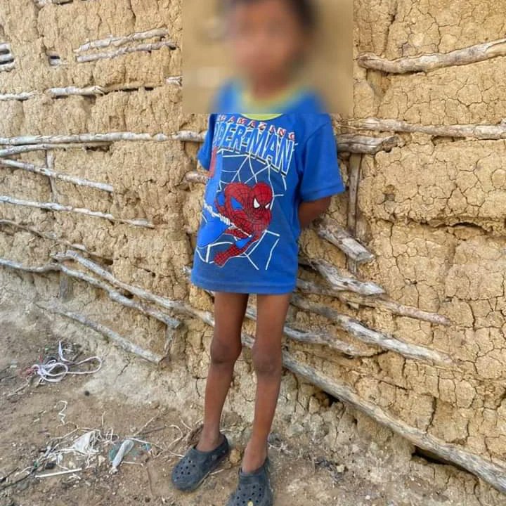 PachecoPalmar's tweet photo. 85 #NIÑOS muertos por desnutrición,no existe piedad en cada uno de los que proclaman trabajar por la Guajira. exigimos el cumplimiento de la sentencia de la corte constitucional T-302 del 2017. ICBF una institución del mal. Que el paro continue #hastaqueladignidadsehagacostumbre https://t.co/fvs0YNtnG2