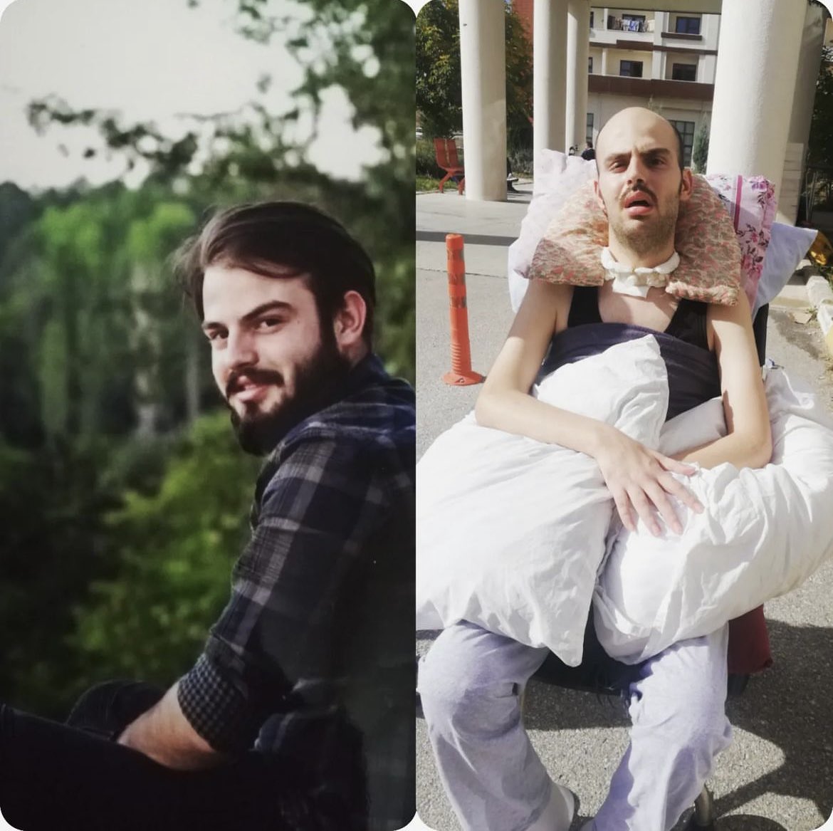 Askerlik görevi esnasında düşme sonucu beyin kanaması geçirip, iki ay komada kaldıktan sonra felçli uyanan Arif Yılmaz’ın sevenleri kökhücre nakli için hayırseverlerin Kütahya Valiliği onaylı yardım kampanyasına desteğini bekliyor. #arifesesol <a href="/haluklevent/">Haluk Levent ( Ahbap Ekibi )</a> @Ahbap_Kutahya <a href="/ahbap/">Ahbap</a>